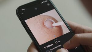 wyciskanie pryszczy filmy na ekranie smartfona